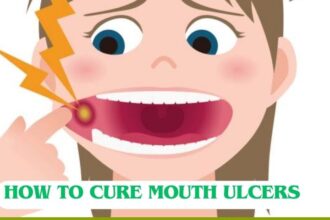 Home remedies for mouth ulcers: 10 Prevention from Mouth Ulcer